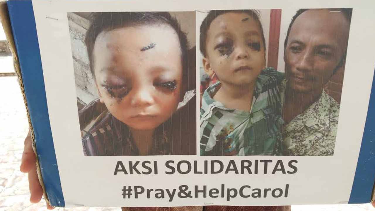 Foto Carol Kristian Daeli yang saat ini sangat menbutuhkan bantuan anda (Foto: Eksaudin Zebua)